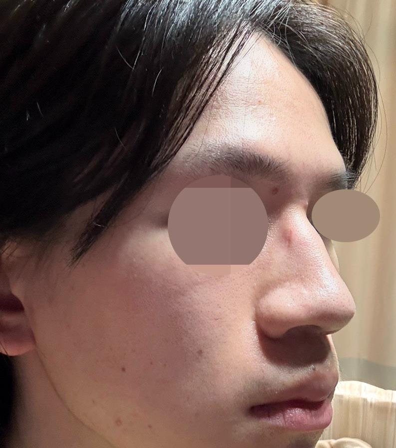 後
