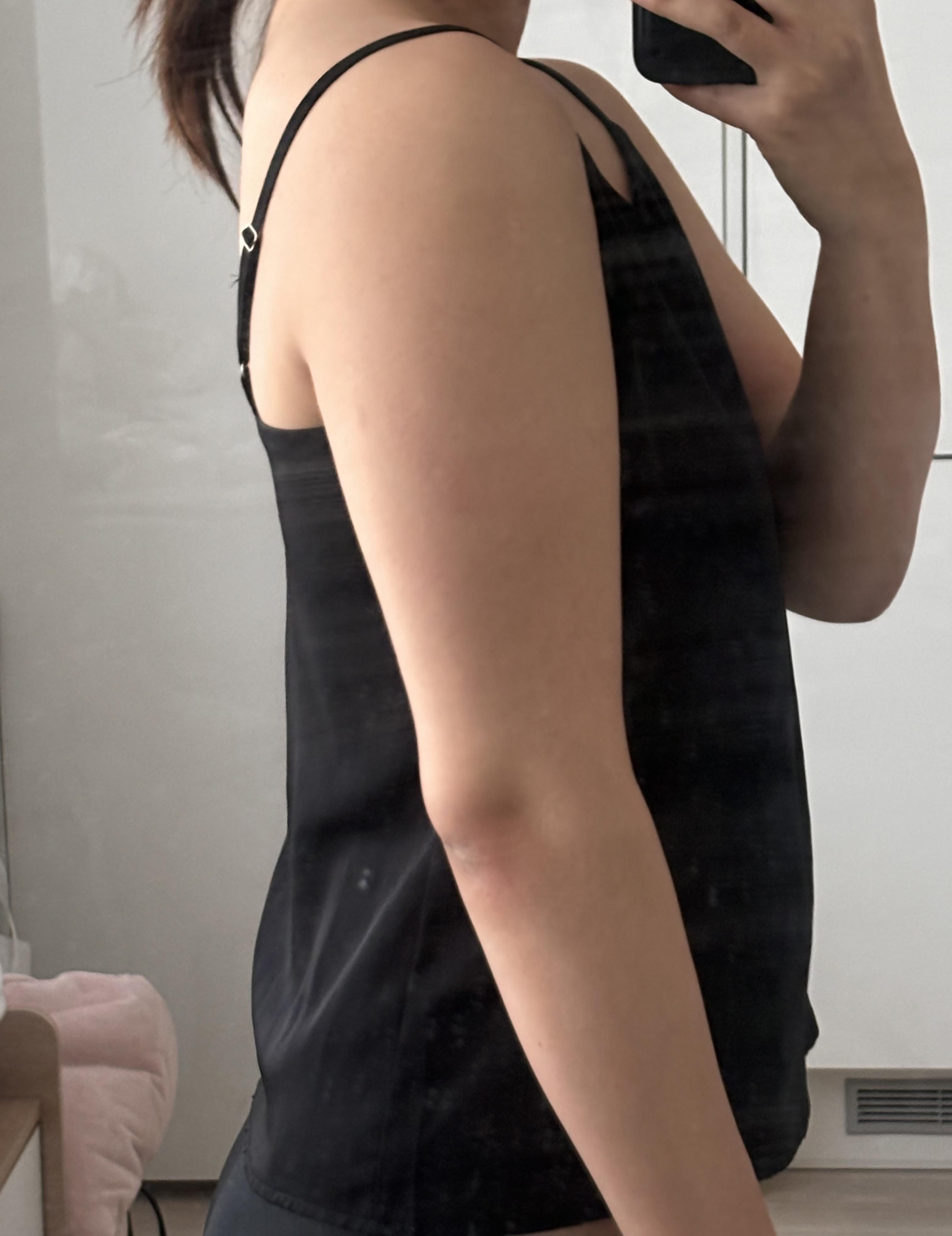 後