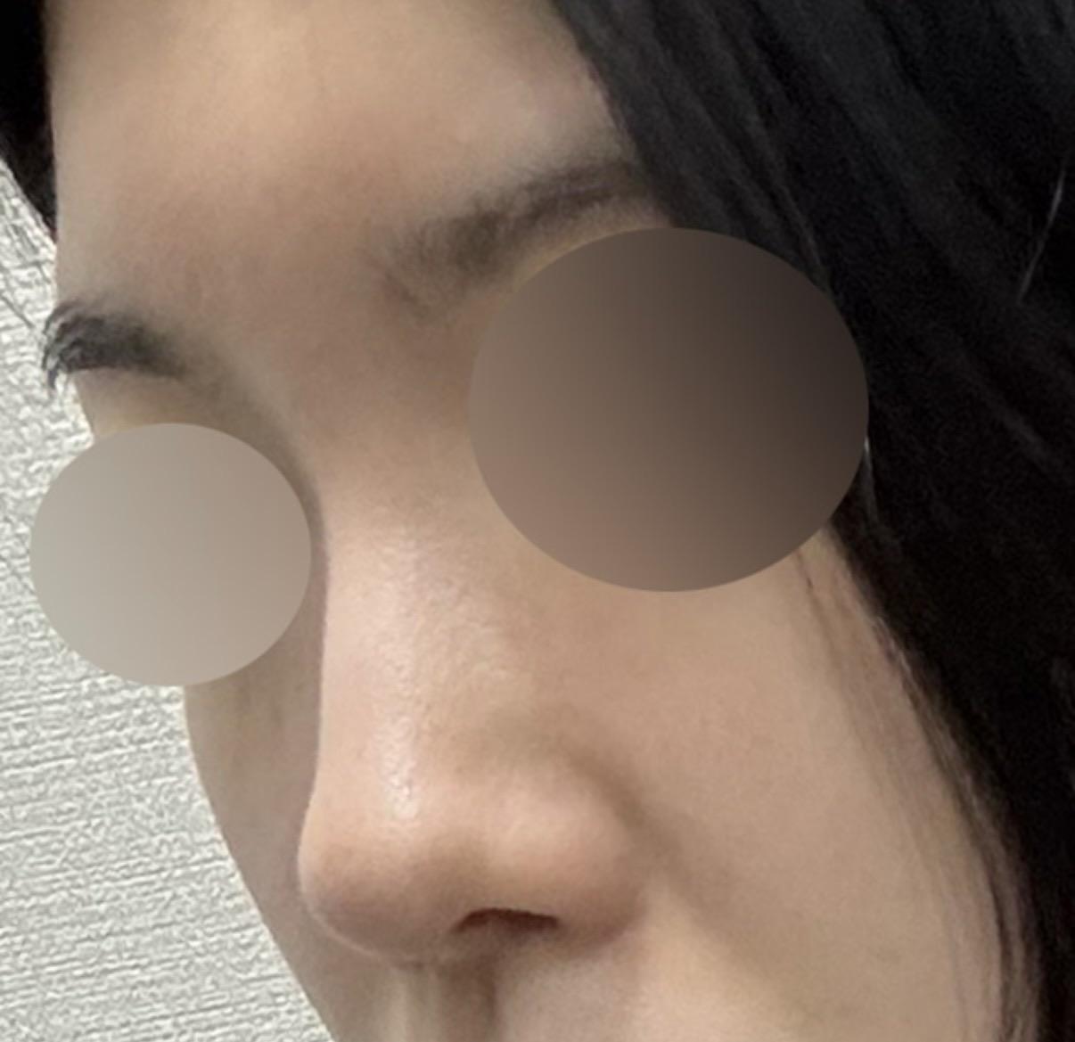 後