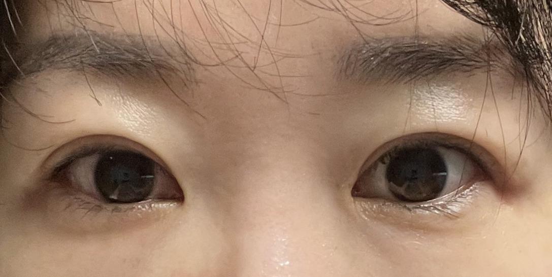 後