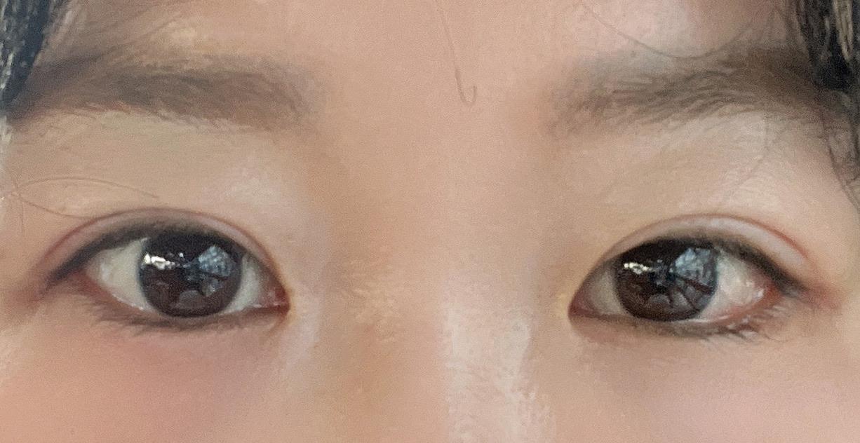 後
