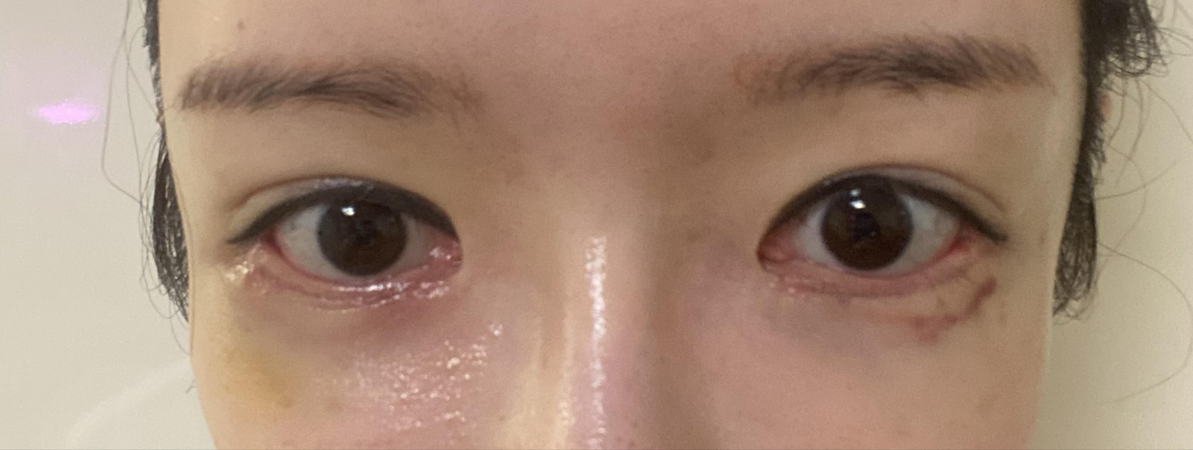 後