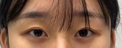後