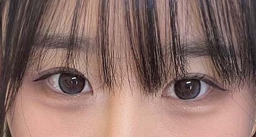 後
