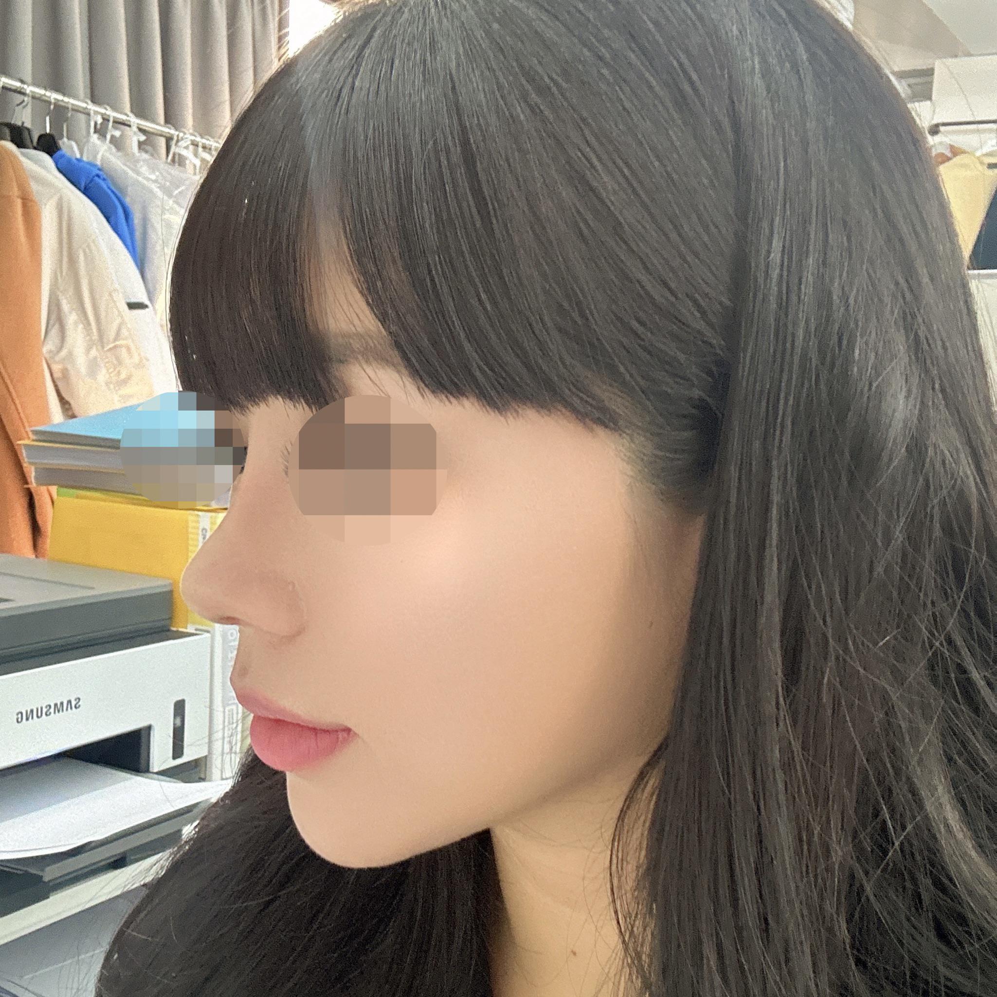 後