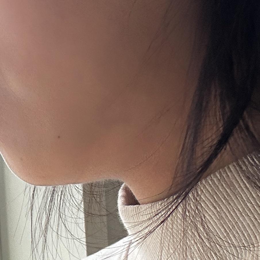 後