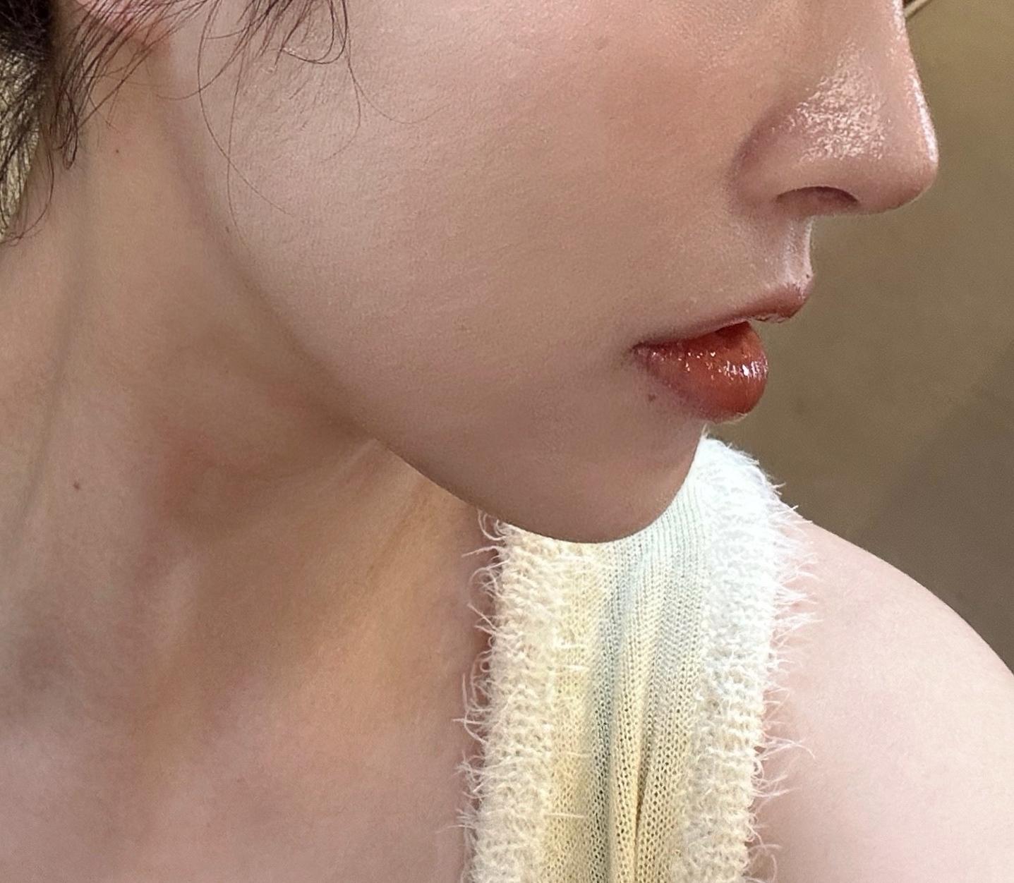 后
