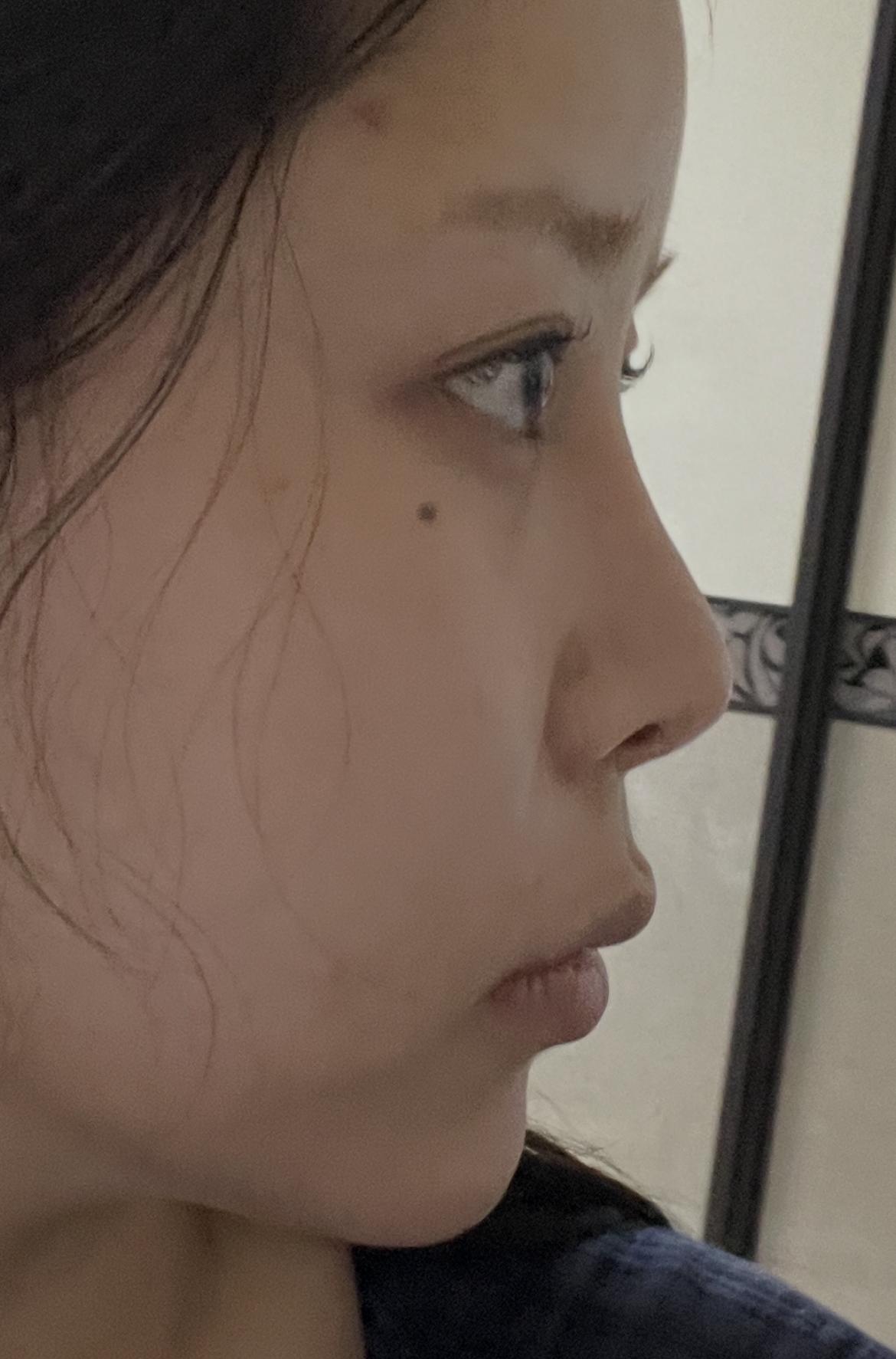 後