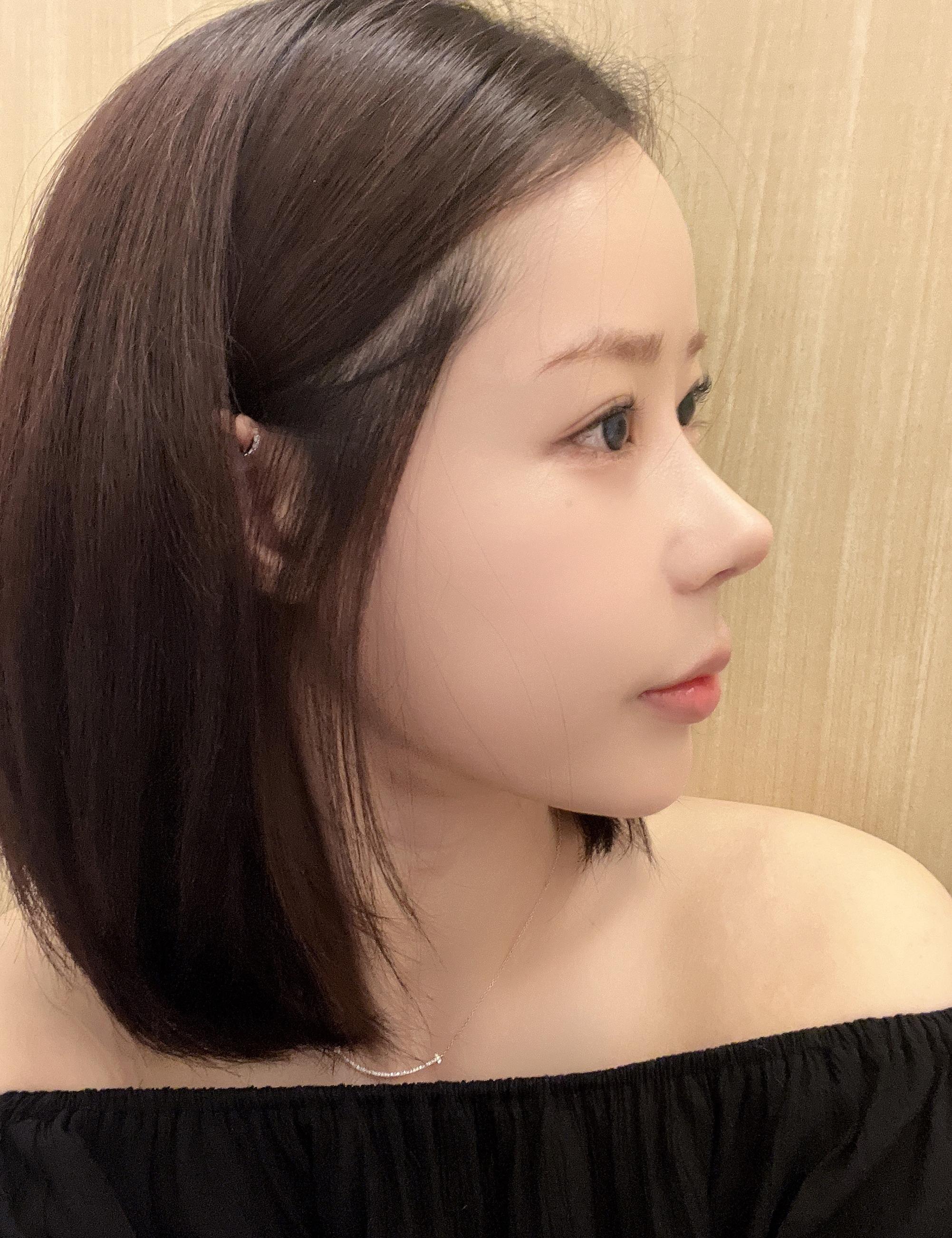 後