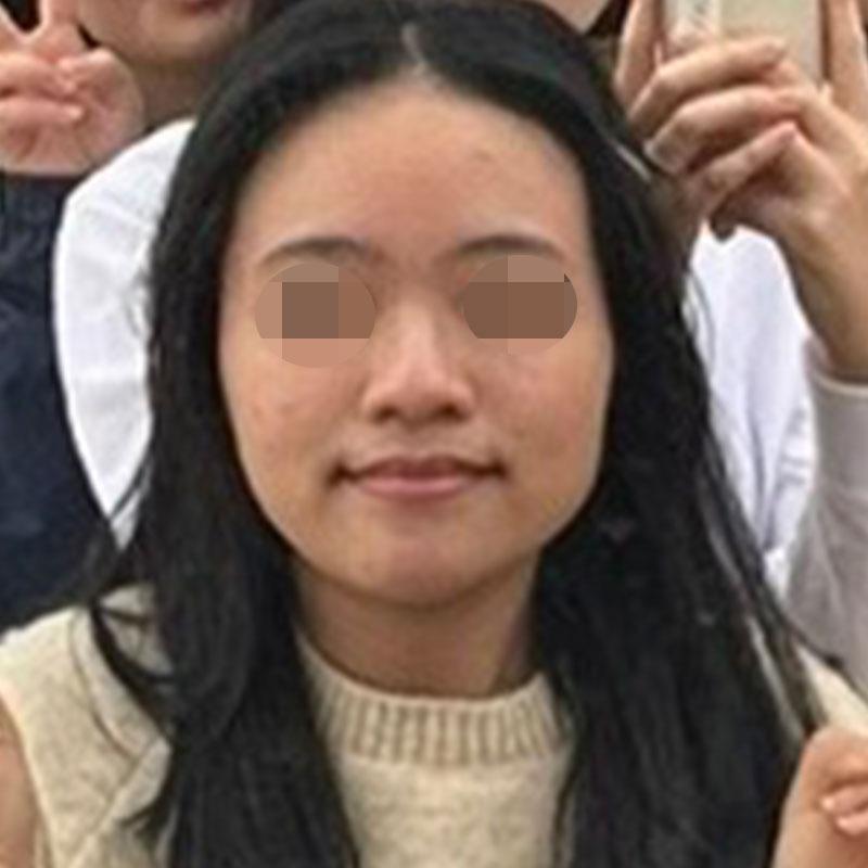 前