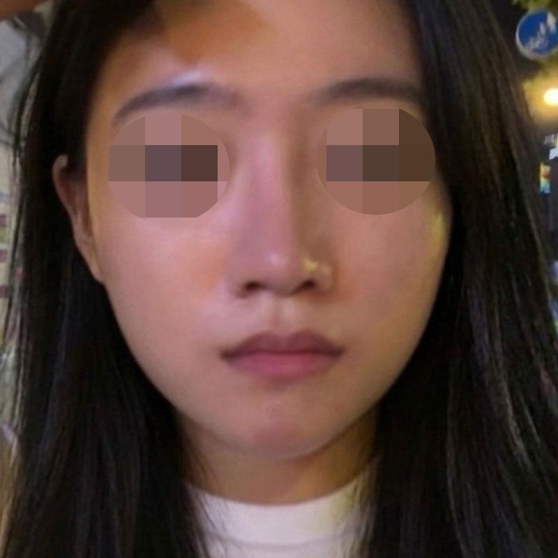 后