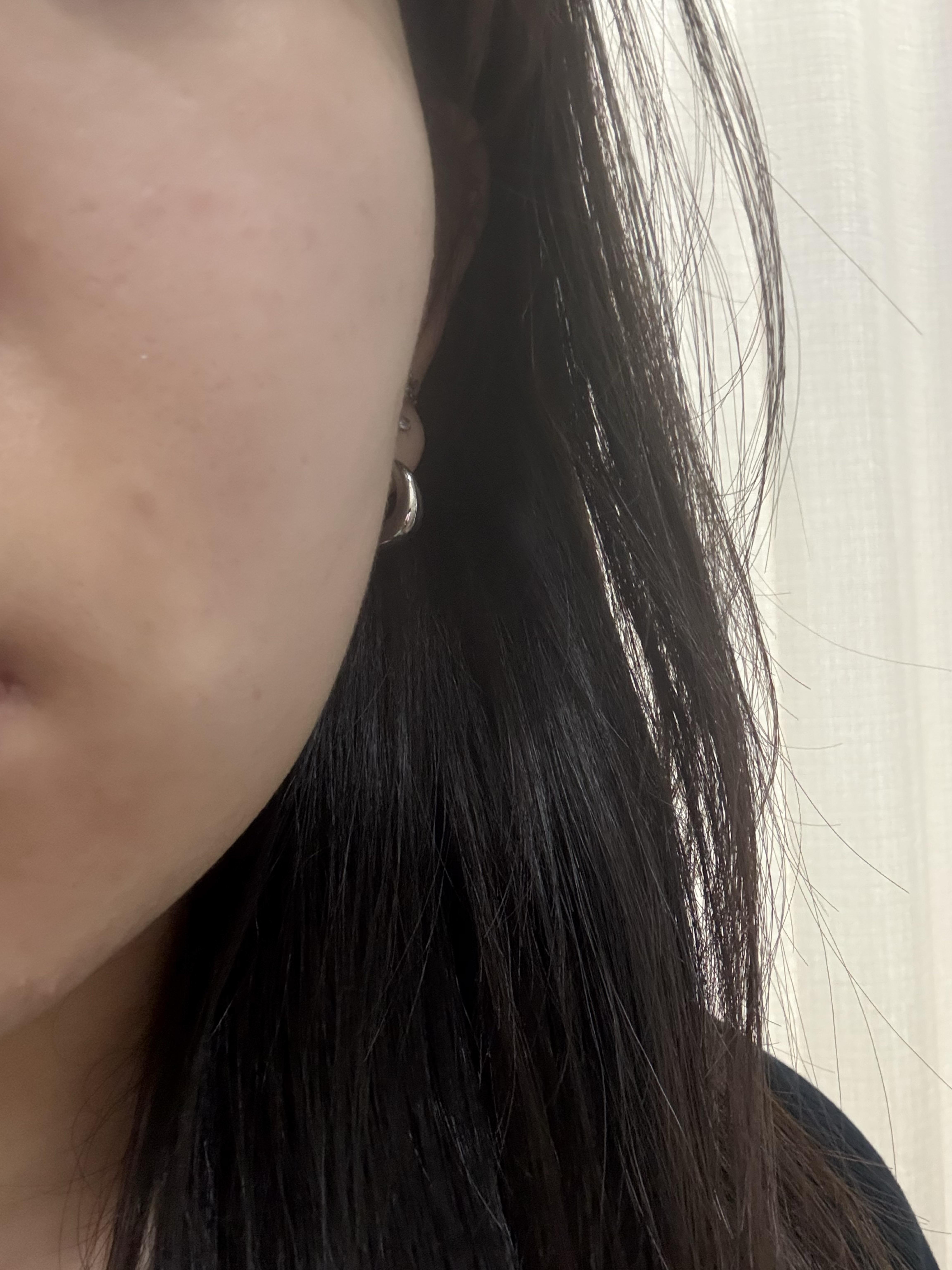 Before