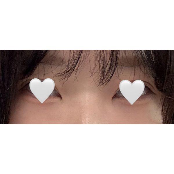 后