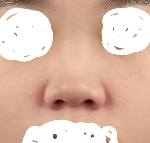 後