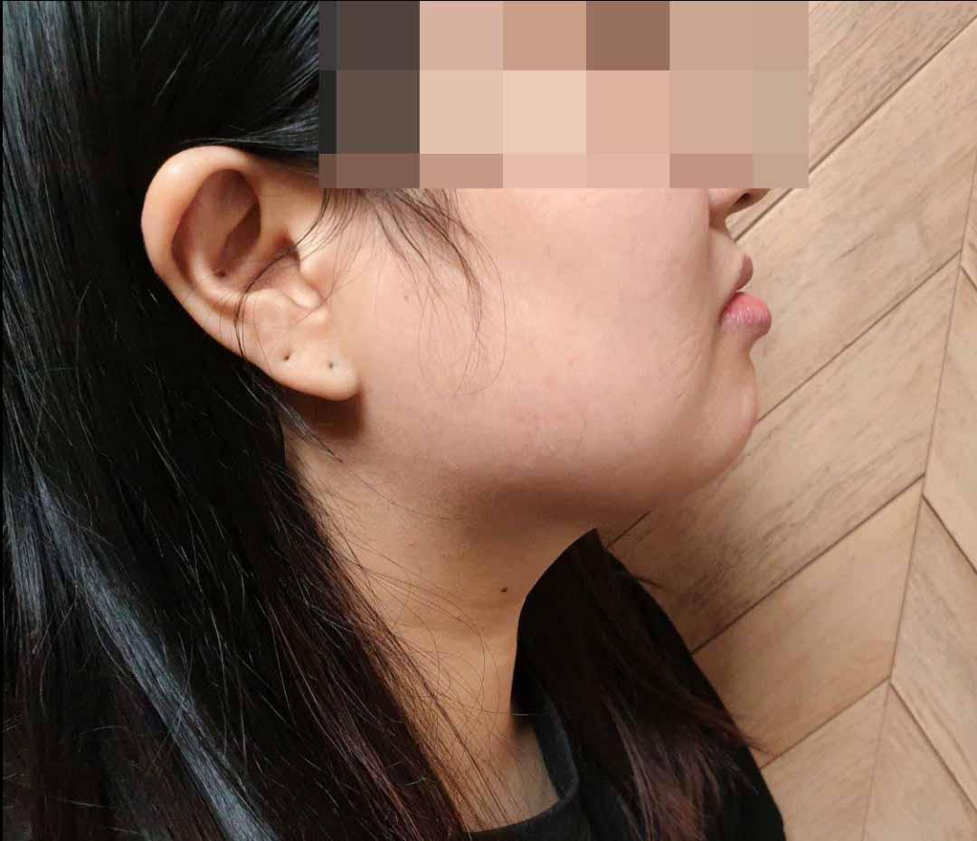 後