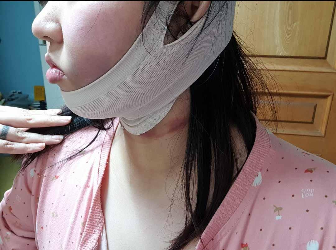 後
