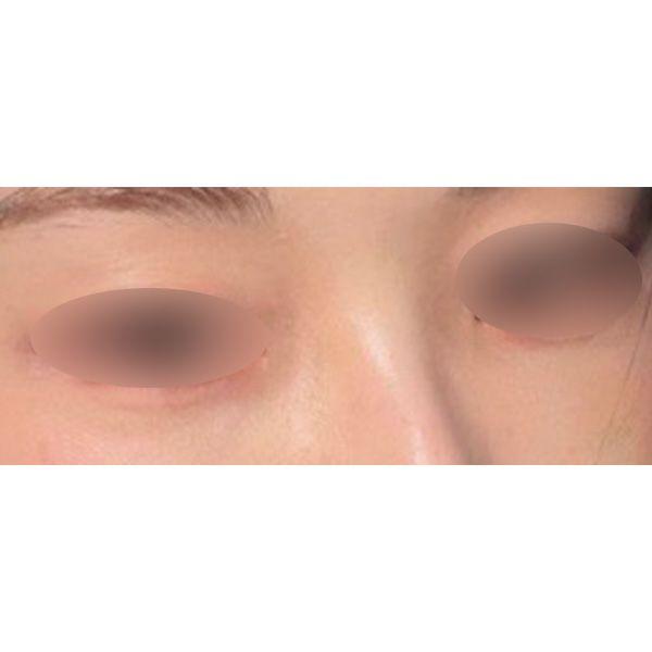 后