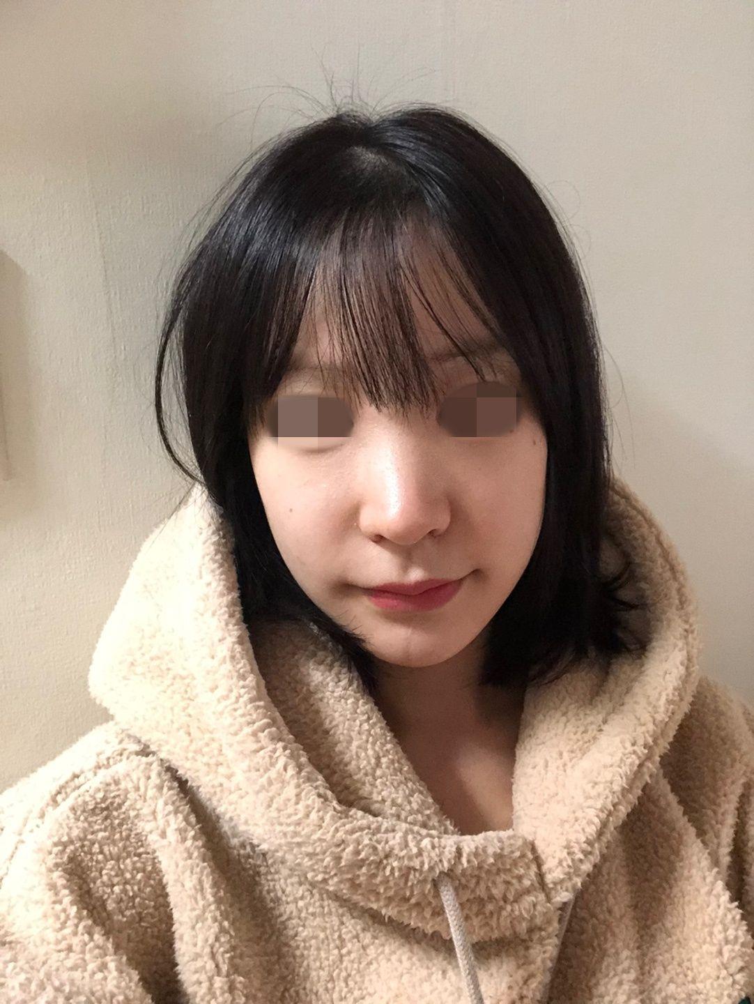 後