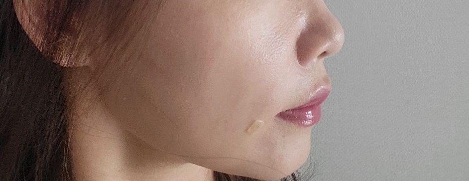 後