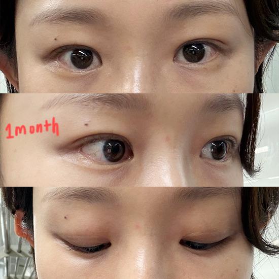 后