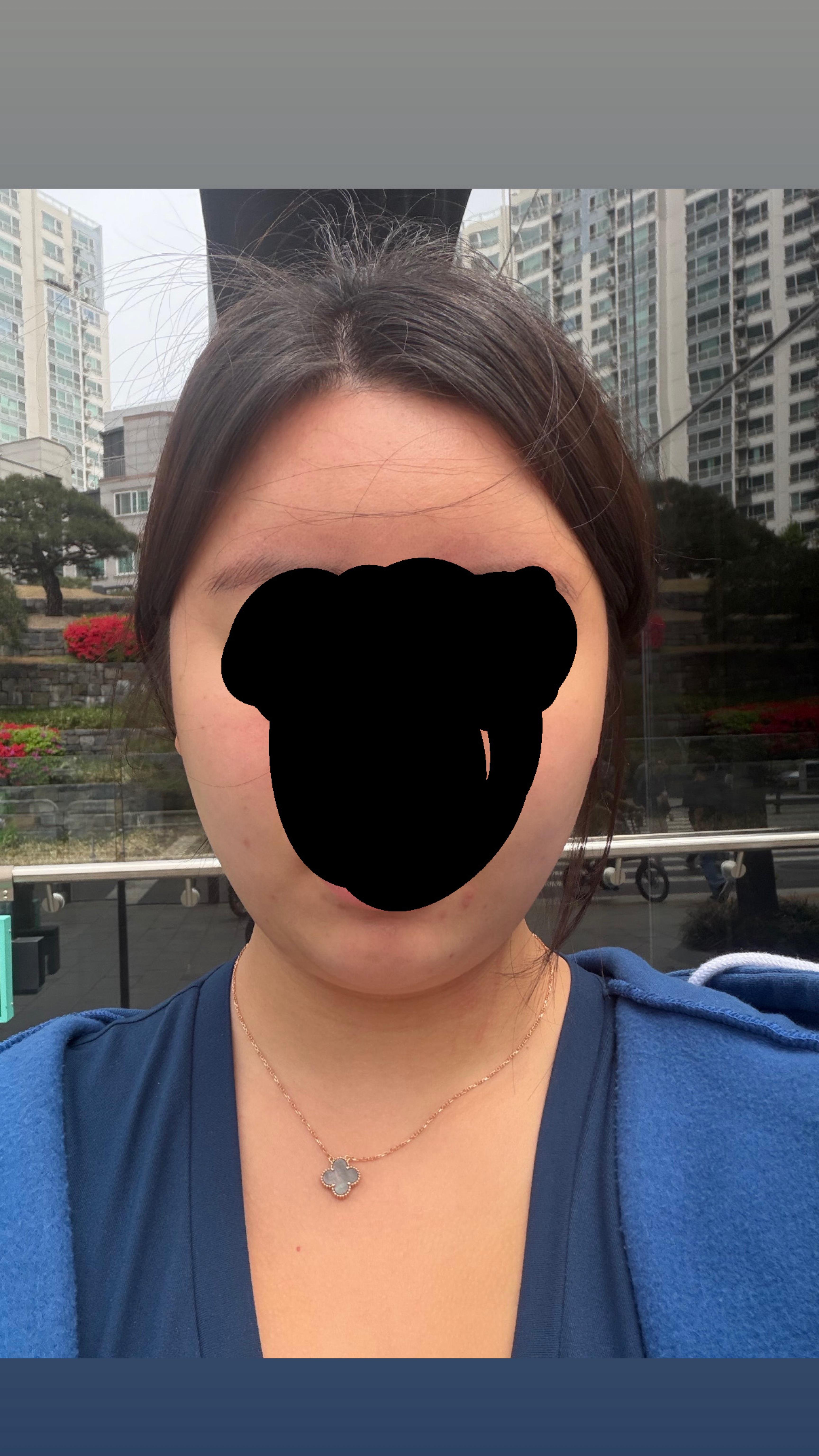 後