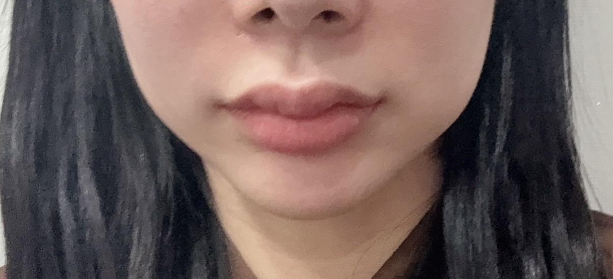 後