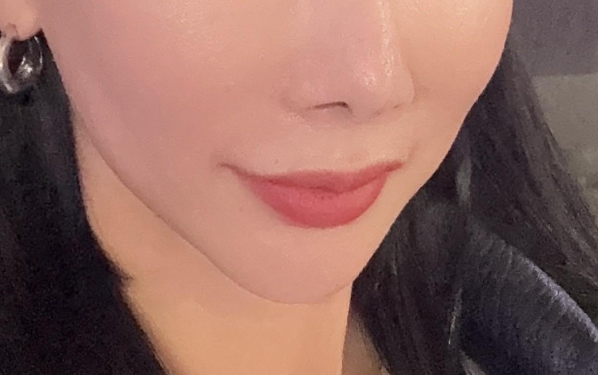 後