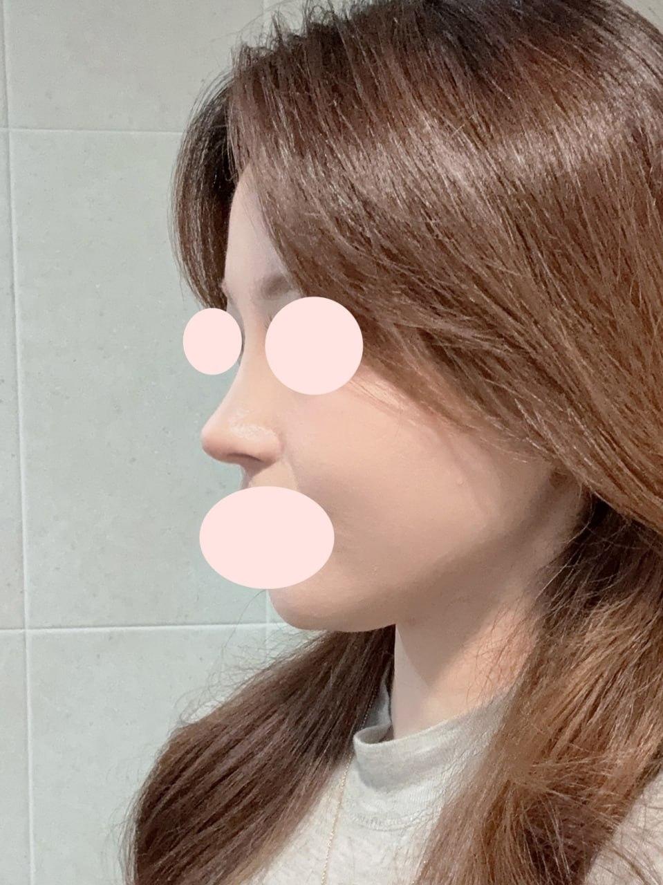 後