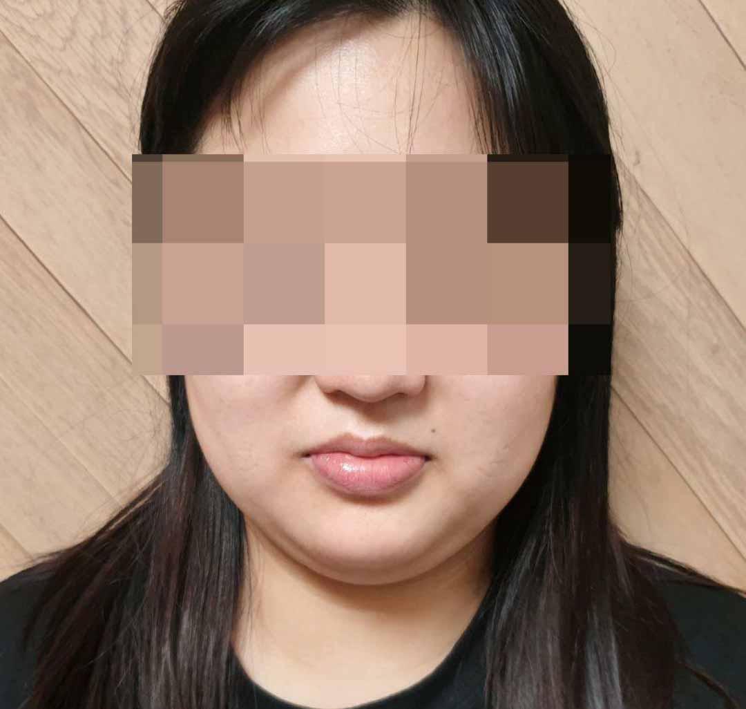 後