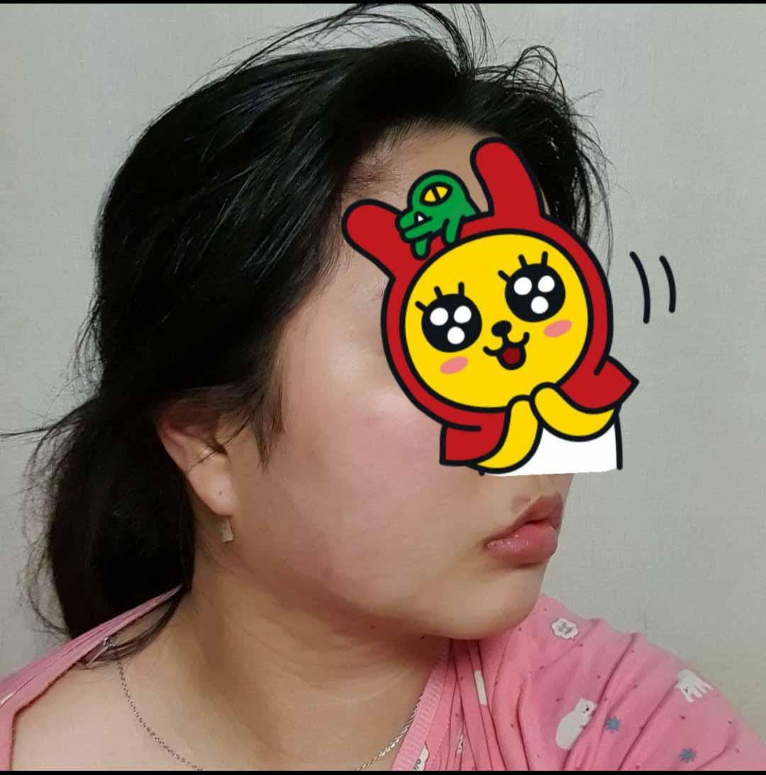 後