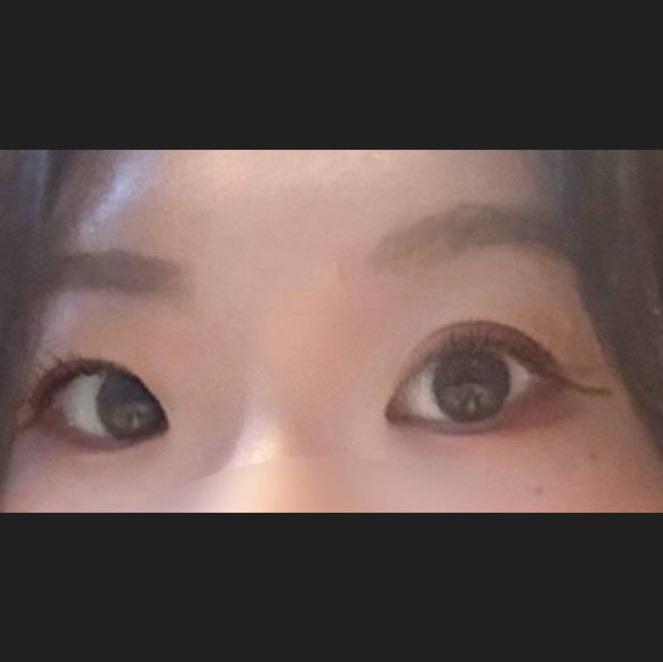 後