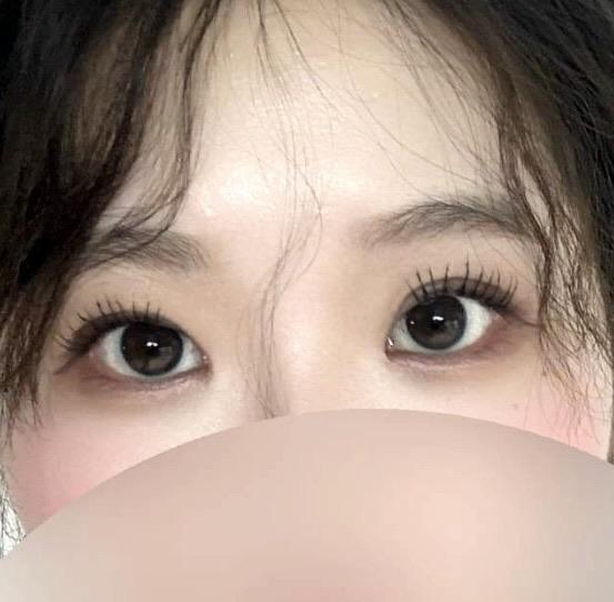 後