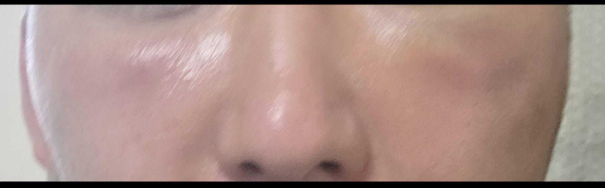後