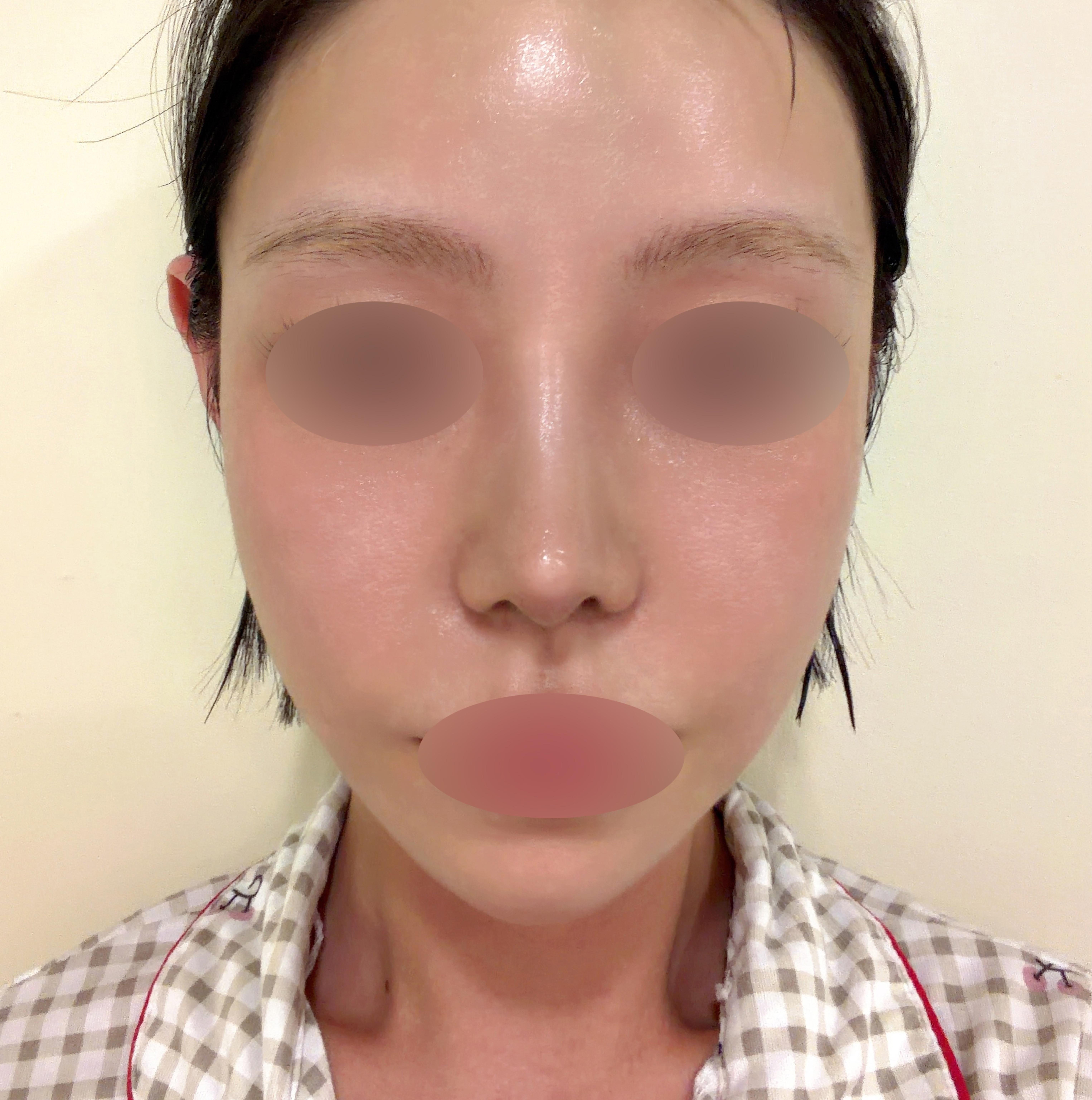 後