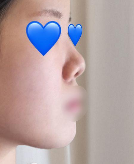 後