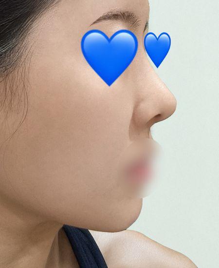 後