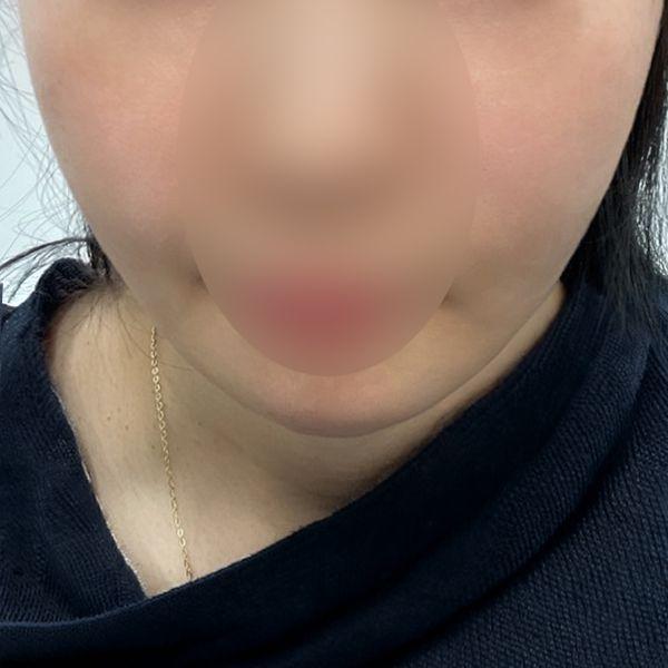 後
