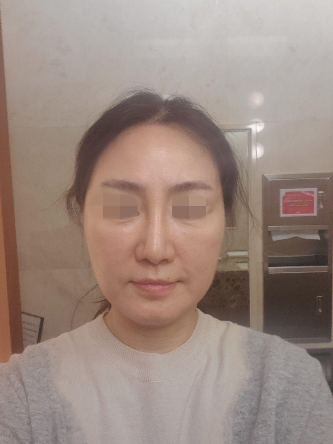 後