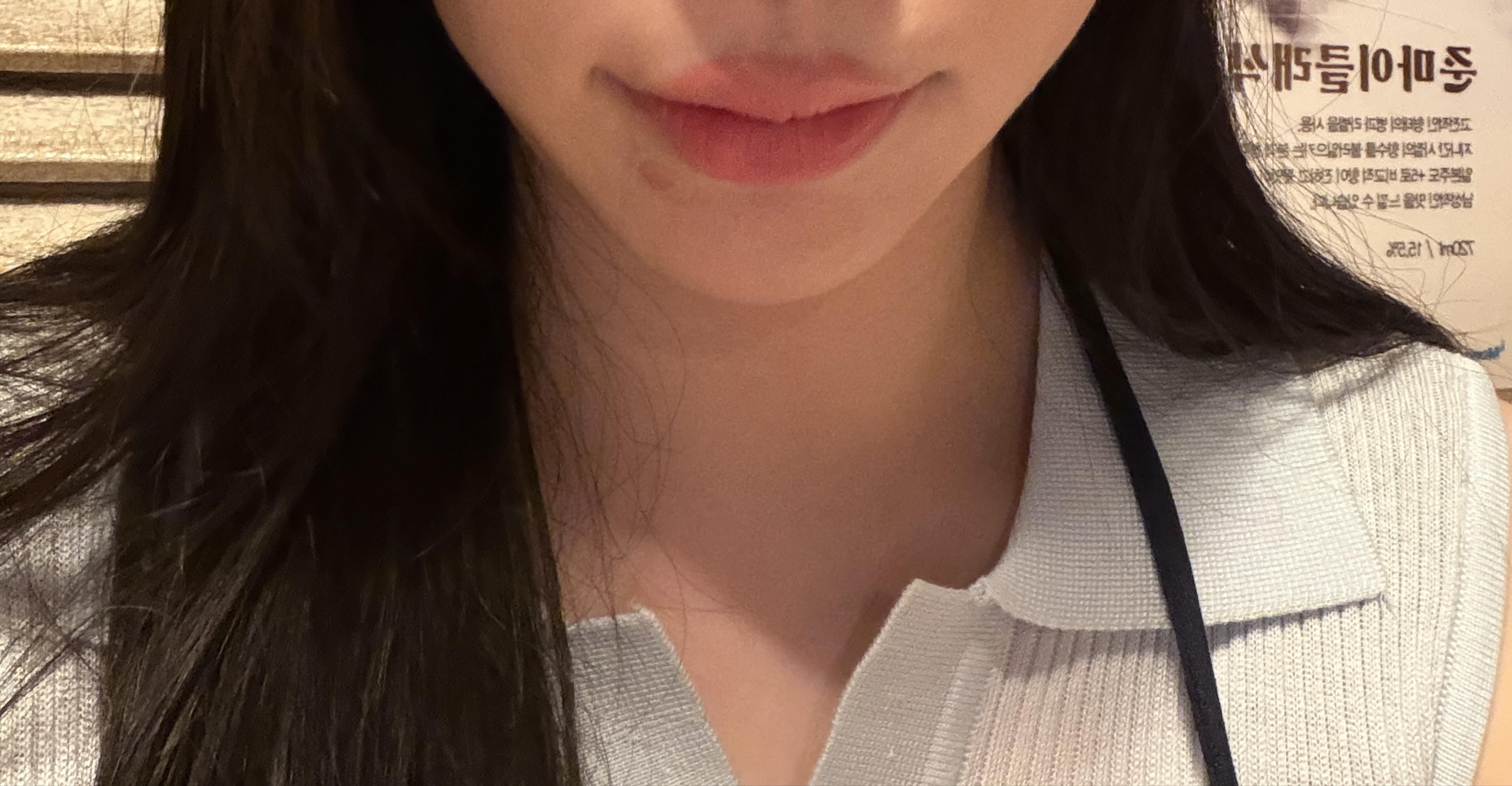 後
