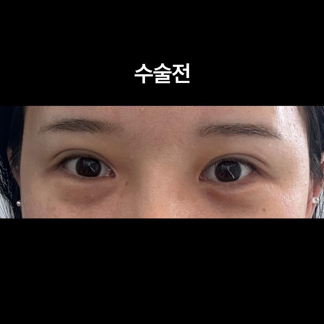 後
