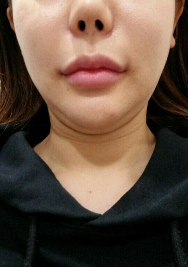 後