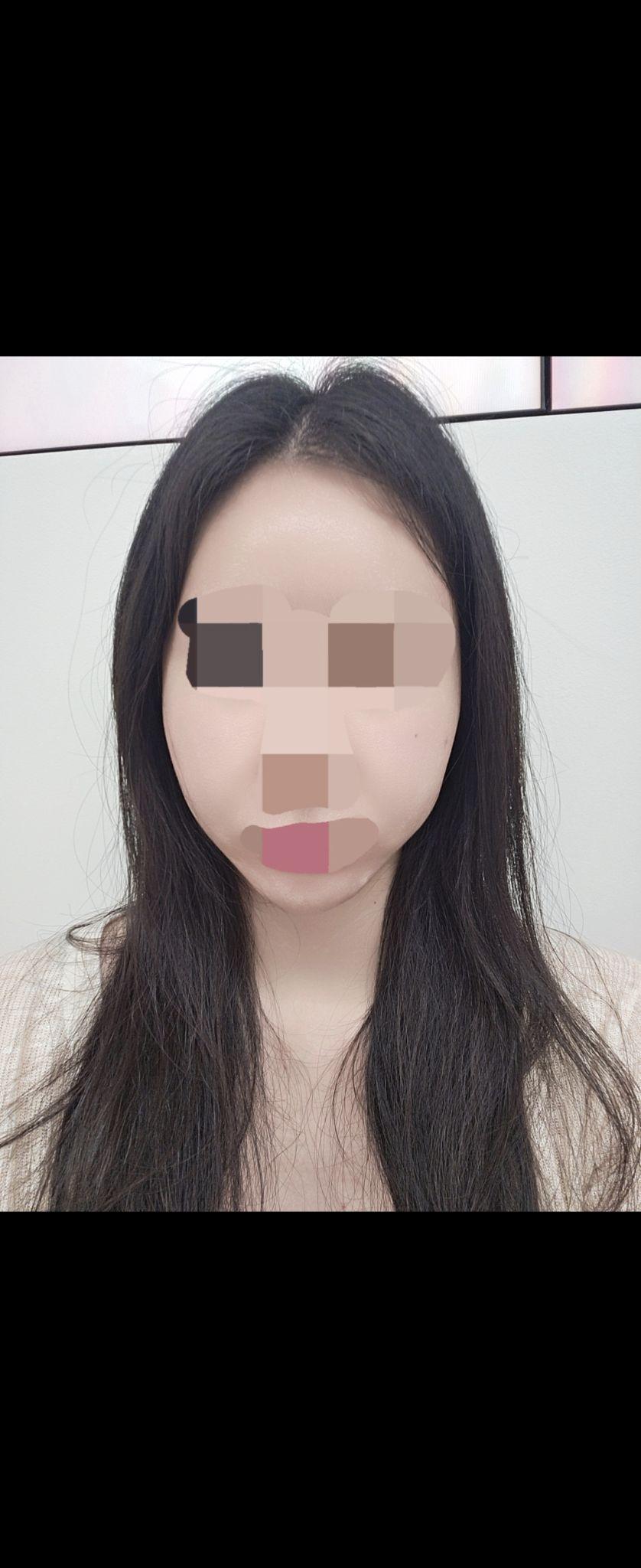 後