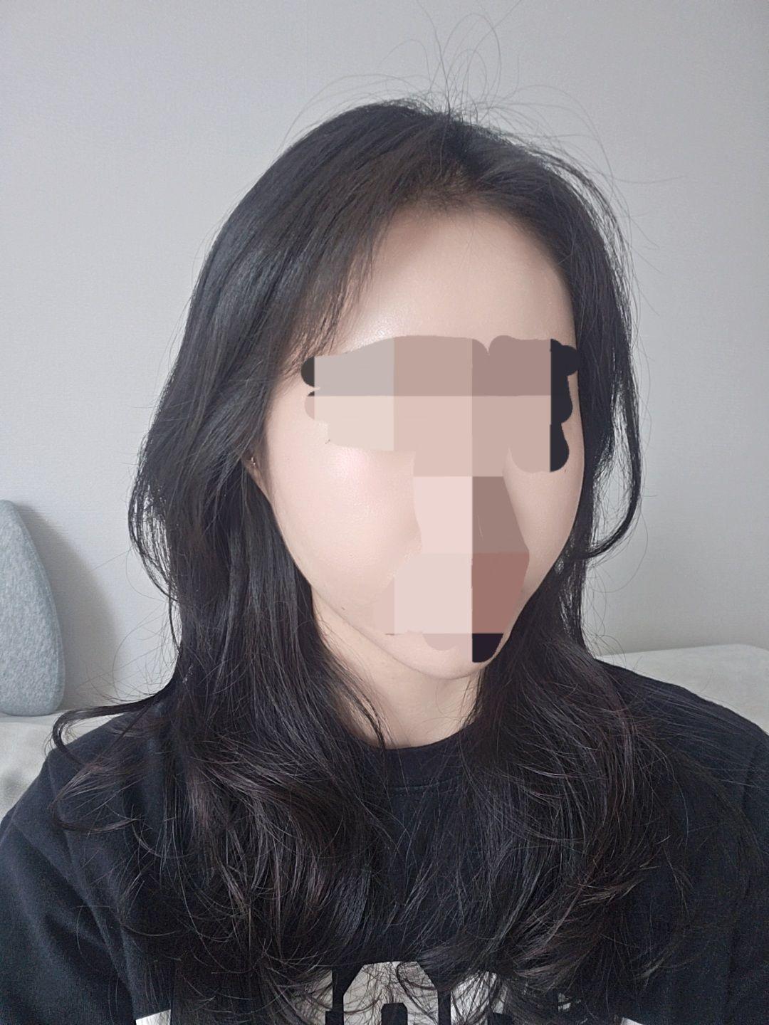 後