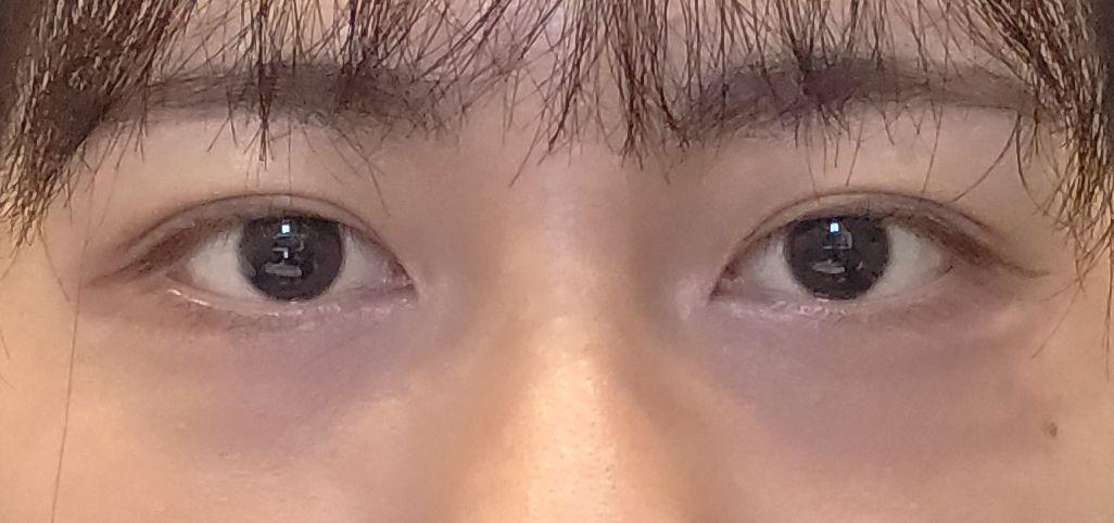 后
