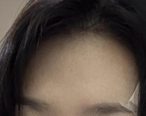 後