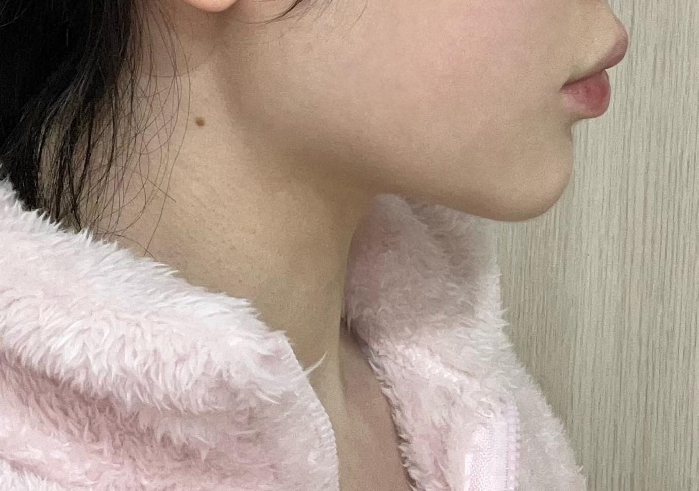 後