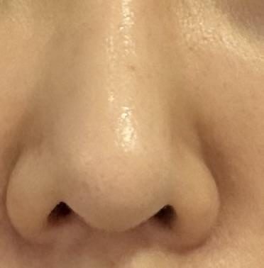後