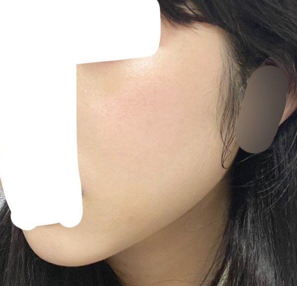後