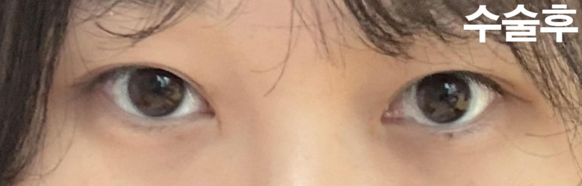 后