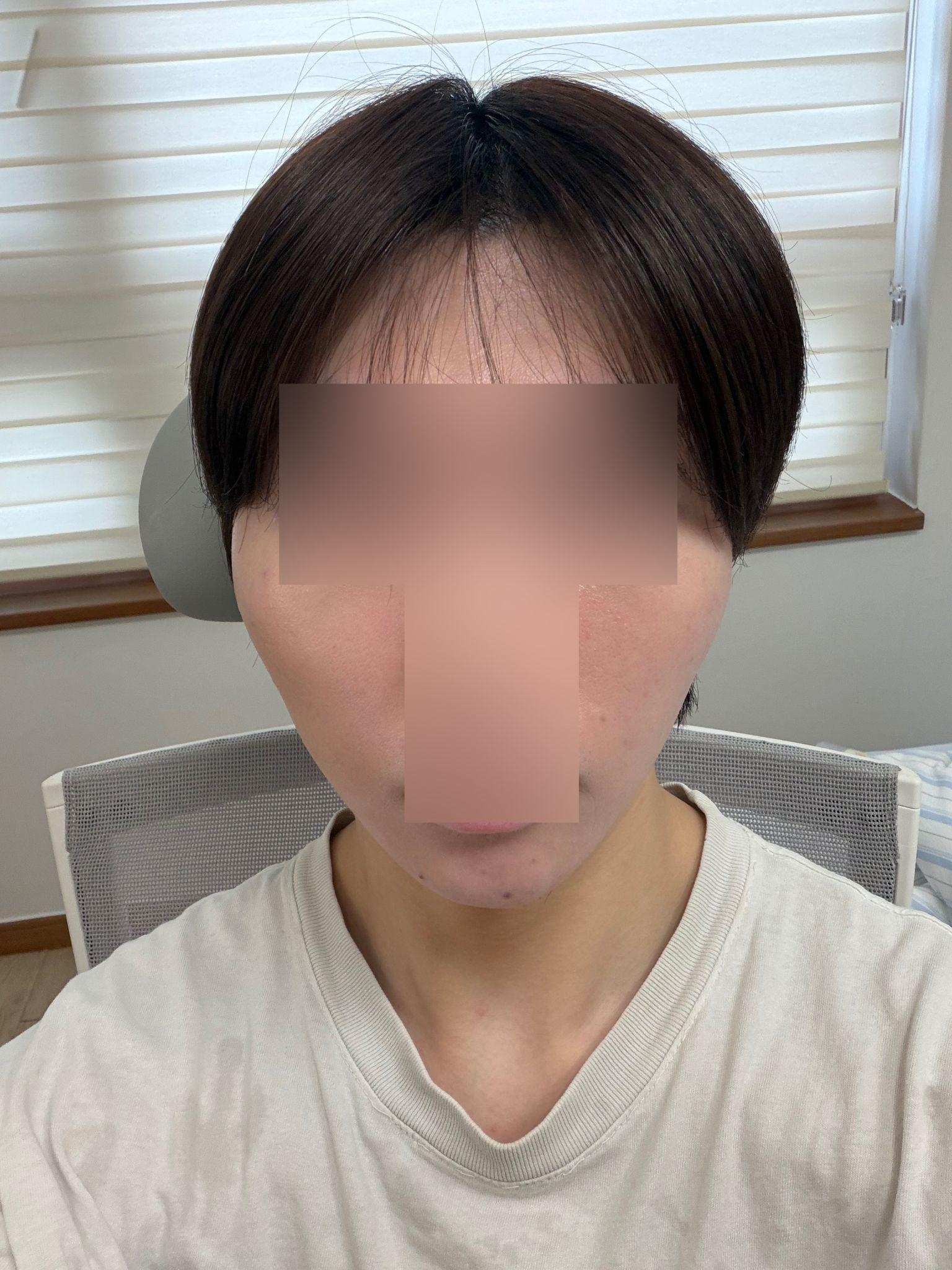 後